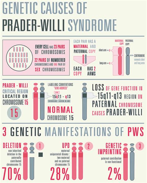 prada willi syndrome sargent|prader willi syndrome prevention.